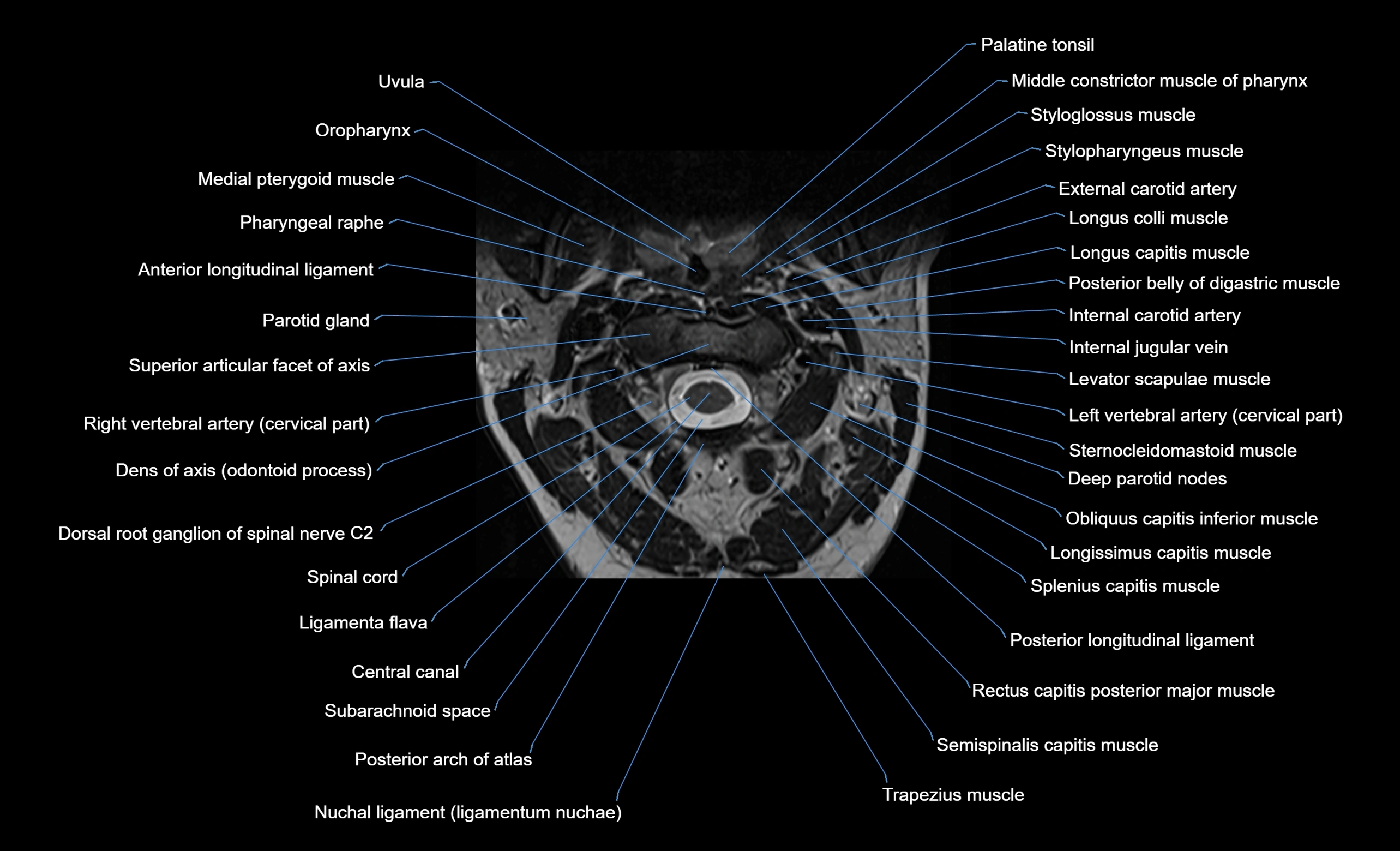 cervical spine cross sectional MRI anatomy  3T MRI axial  image-img-00001-00009.webp